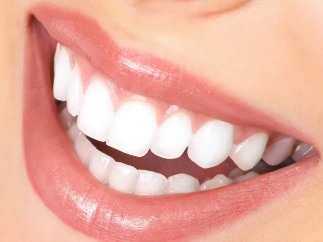  Estetska dentalna medicina 